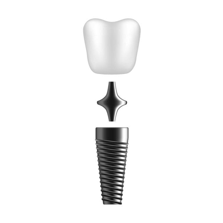 Dental Crown